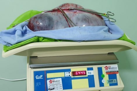 Divulgação / Hospital Frei Clemente